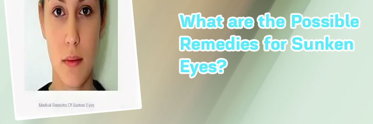 Makeup for sunken eyes